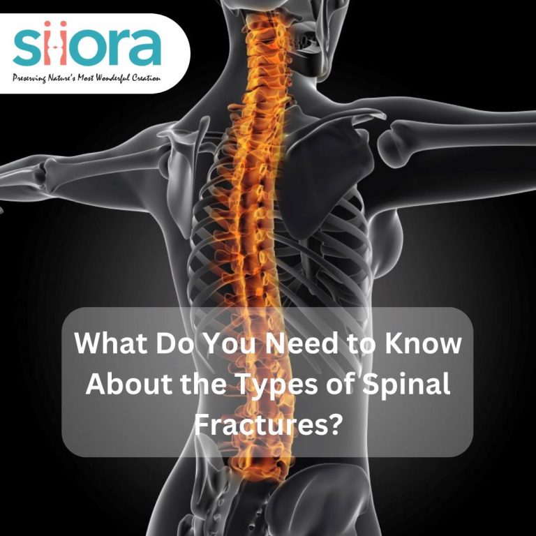 What Do You Need to Know About the Types of Spinal Fractures?