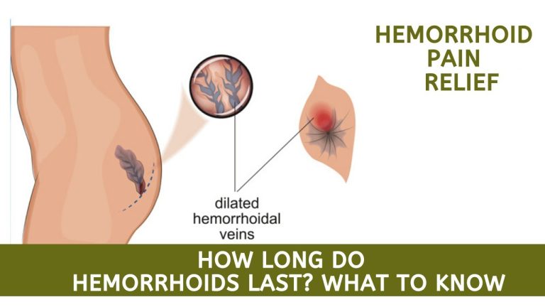 Know how long do hemorrhoids last & how to prevent it….