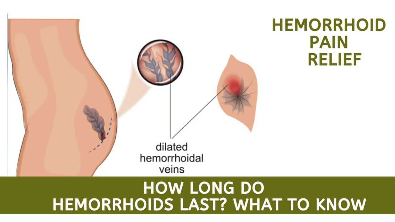 how long do hemorrhoids last