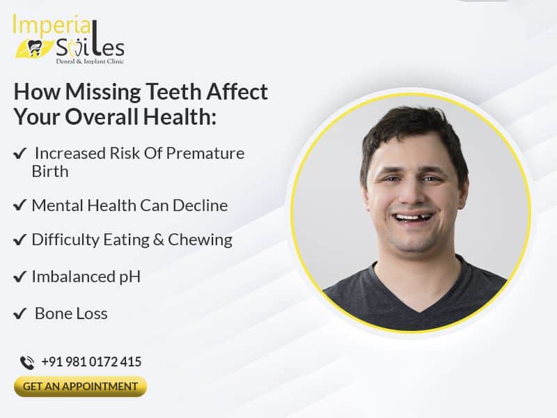 Dental Implants in Gurgaon