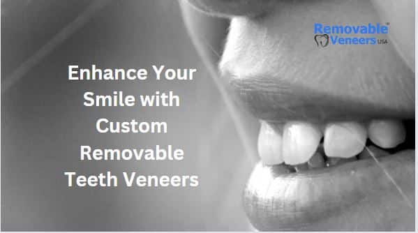 Discover Snap On Veneers: Enhance Your Smile without Breaking the Bank