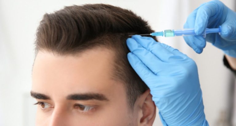 How Can Hair Transplantation Help in Getting Rid Of Pattern Baldness?