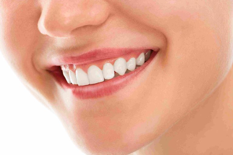 How to Choose Reliable Teeth Whitening Services for a Dazzling Smile in Dubai