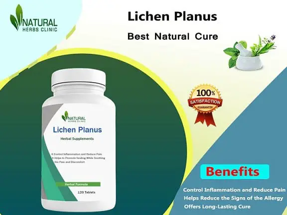 Revolutionary Lichen Planus Cure Rediscovering Your Skin