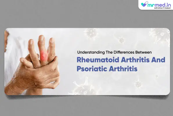 Understanding the Differences Between Rheumatoid Arthritis and Psoriatic Arthritis