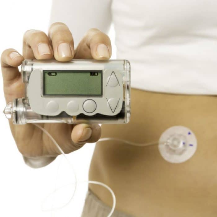 Insulin Pumps Market in USA is projected to expand at a CAGR of around 8.5% from 2022 to 2032