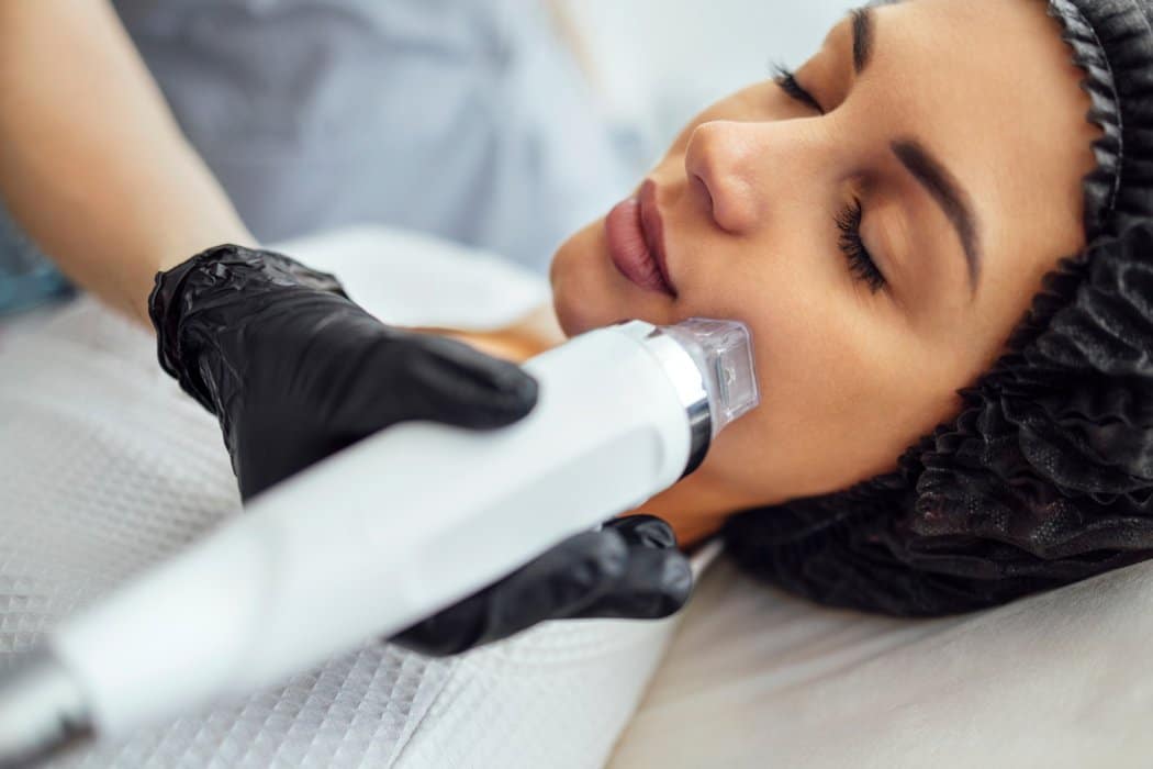 Microneedling near me