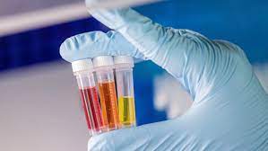 Saudi Arabia In-Vitro Diagnostics Market Growth, Trends, Share, Analysis, and Forecast 2023-2028