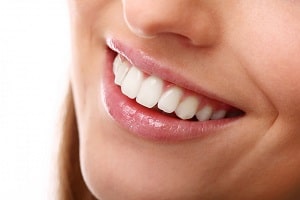 Unveiling the Secrets of Teeth Whitening in The Colony