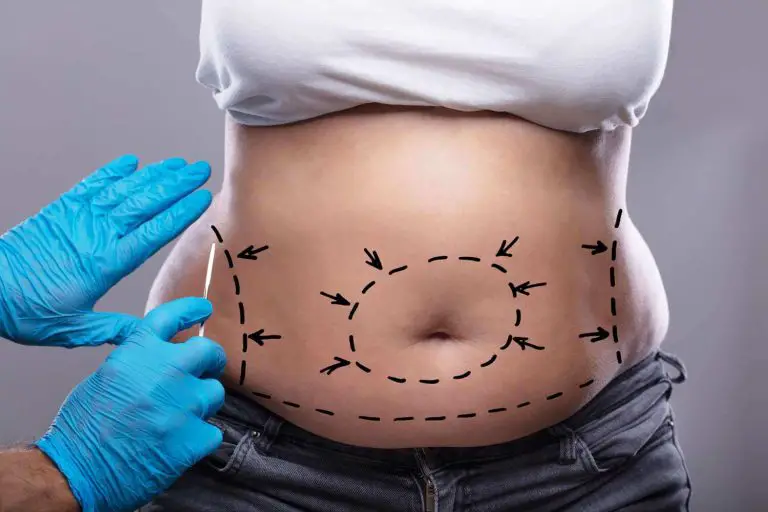 The Importance of Choosing a Board-Certified Surgeon for Your Tummy Tuck in West Palm Beach