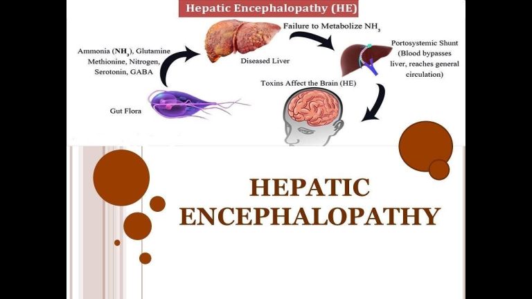 Hepatic Encephalopathy Treatment Market, Anticipating US$ 2971.51 Million by 6.5% CAGR by 2033