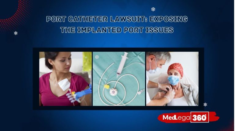 Behind the Port Catheter Lawsuits: Products, Issues, and Patient Safety