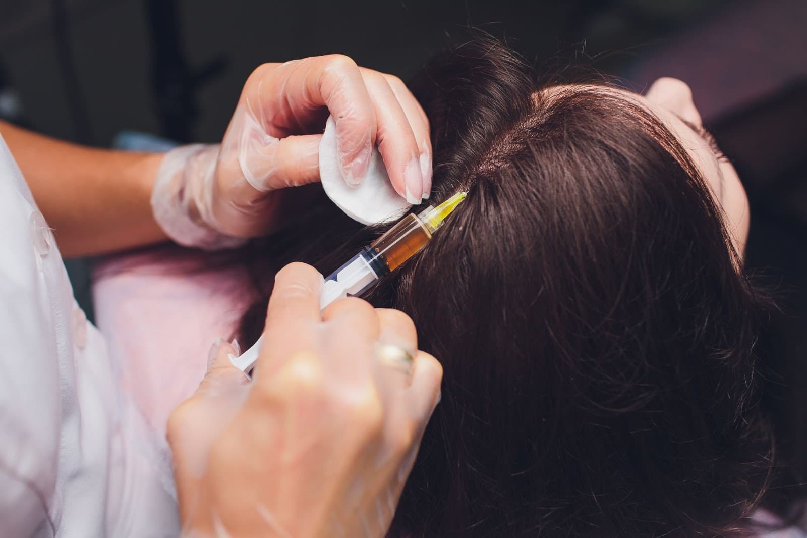 Say Goodbye to Hair Loss Woes Exploring PRP Therapy in Houston