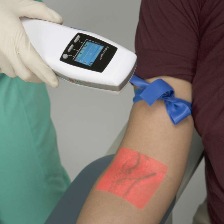 Vein Finder Market Set to Exceed US$ 86.8 Million by 2028