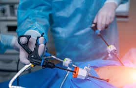 What are the potential complications of laparoscopic cystectomy?