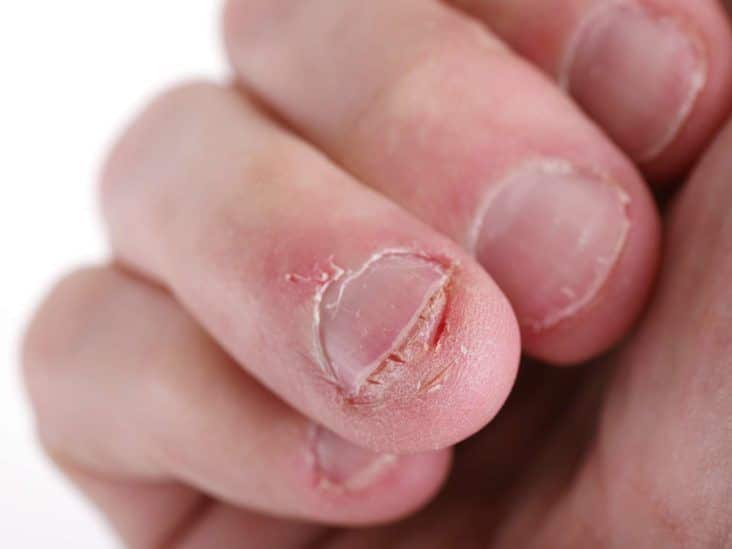 “Dubai’s Glam Fix: Nail Disorders Treatment like Never Before!”