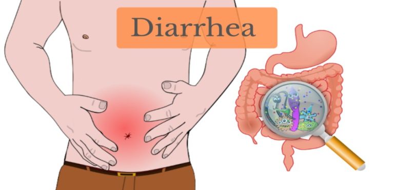 how to stop diarrhea in adults fast