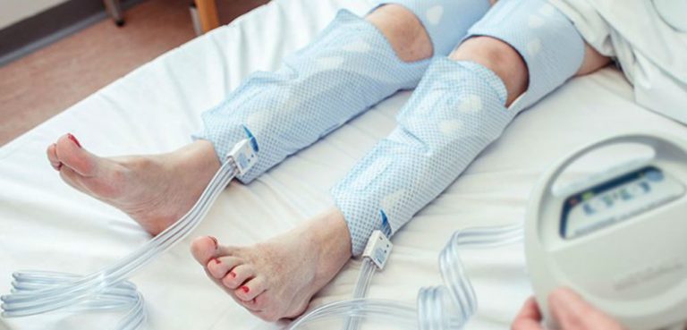 Compression Therapy Market- Industry Share & Trends 2030