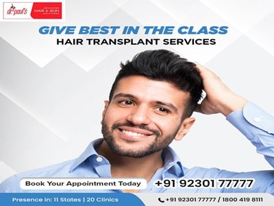 Hair Transplant in Kolkata 4