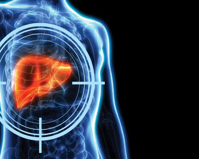 Hepatic Encephalopathy Treatment Market Share, Size & Forecast by 2033