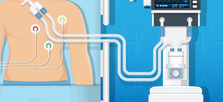 Mechanical Ventilator Market Growth, Forecast to 2033 | FMI