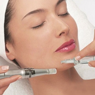 Microneedling in Islamabad: Pioneering the Path to Radiant Skin