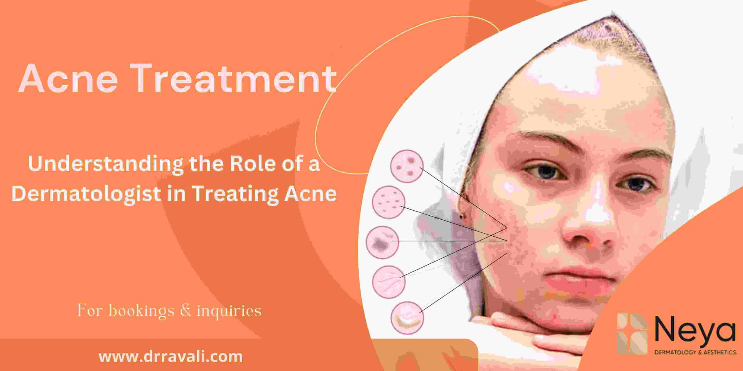 Understanding-the-Role-of-a-Dermatologist-in-Treating-Acne-in-Hyderabad (1)
