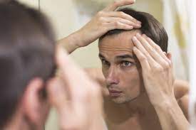 A Hair Transplant Can Give You a Permanent, Natural-Looking