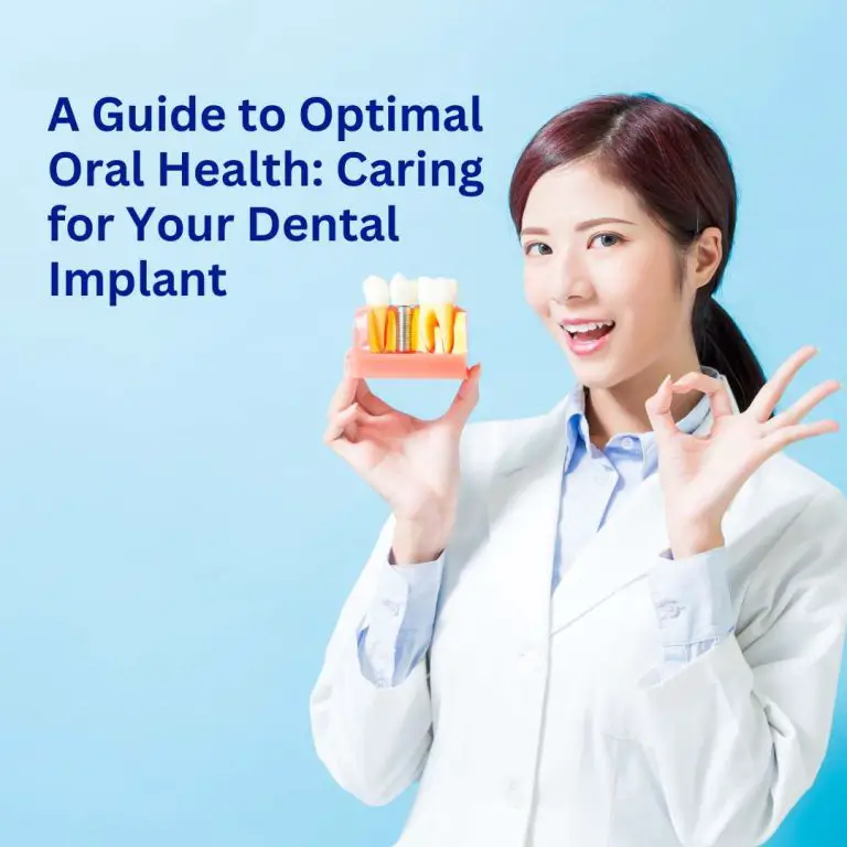 A Guide to Optimal Oral Health: Caring for Your Dental Implant