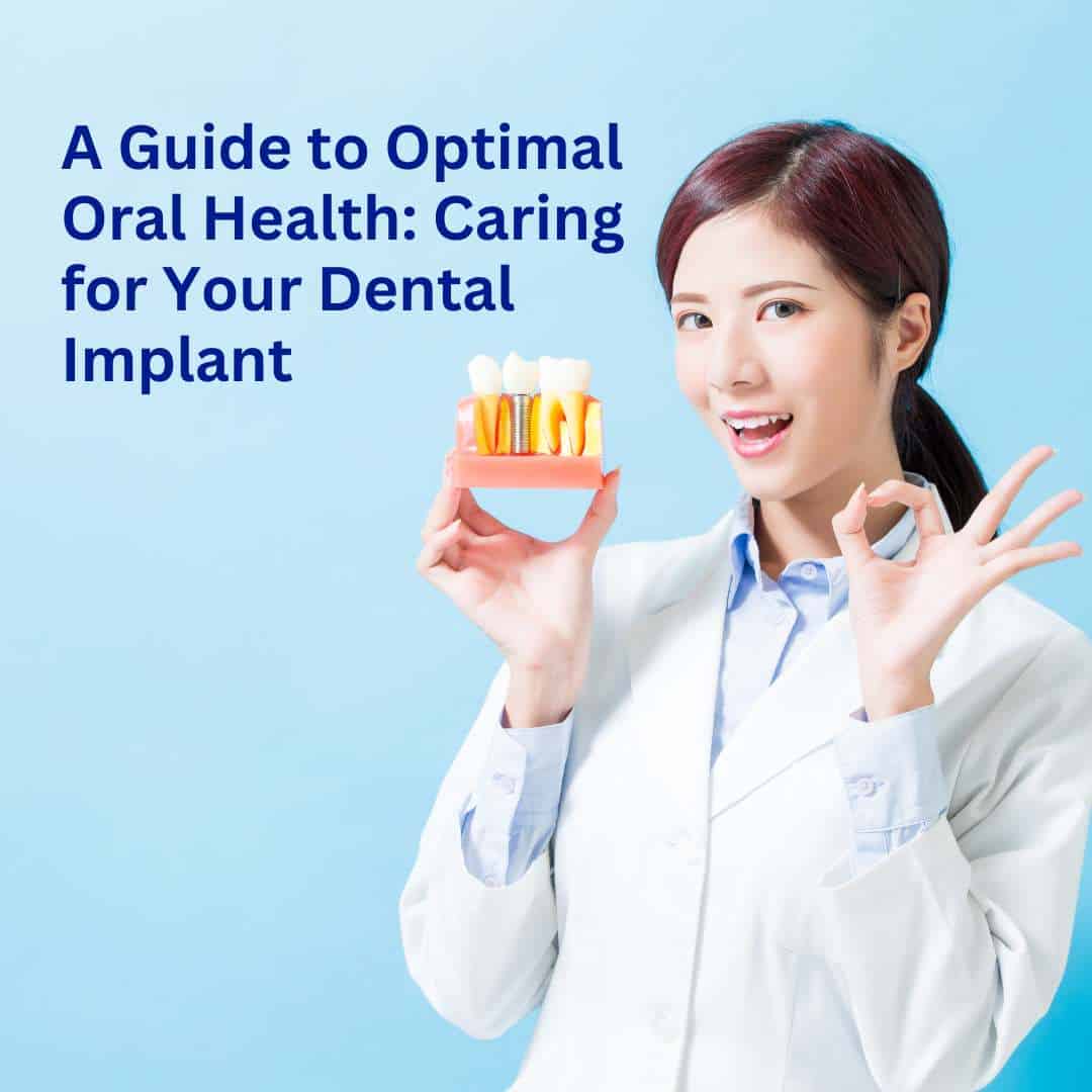 Dental Implant