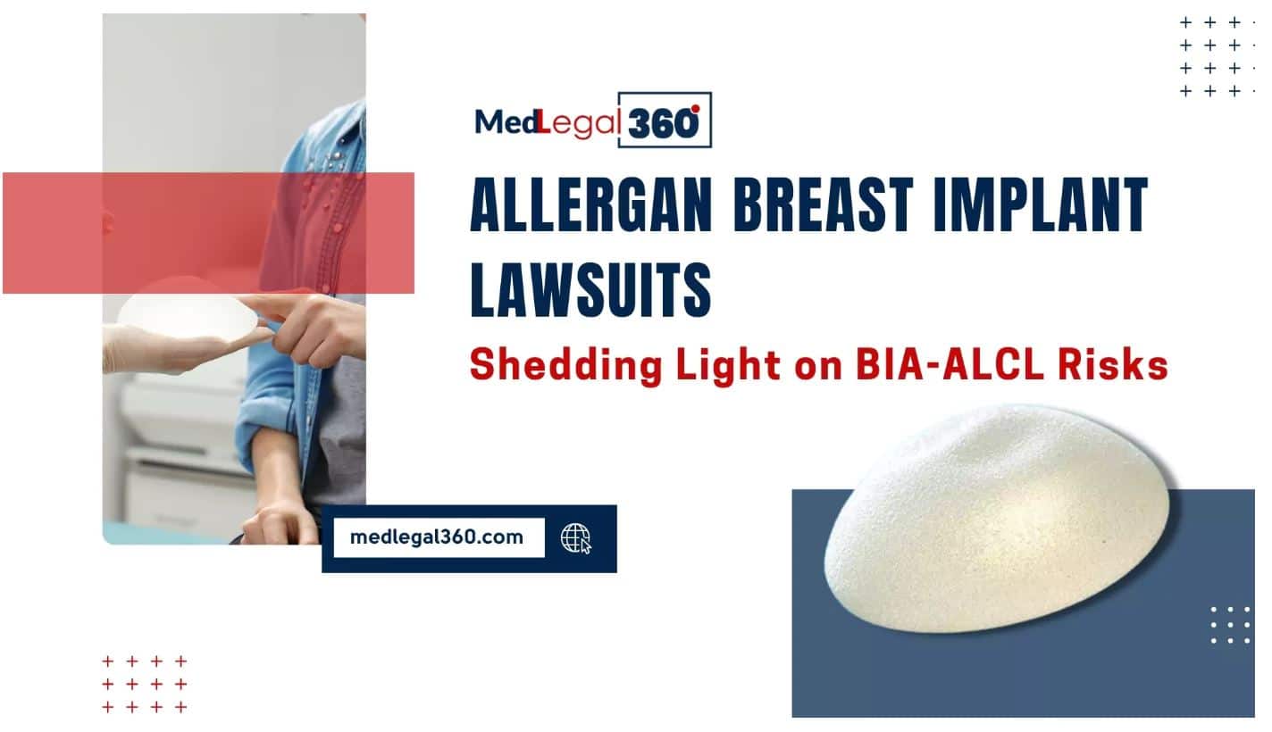 Allergan Breast Implant Lawsuits