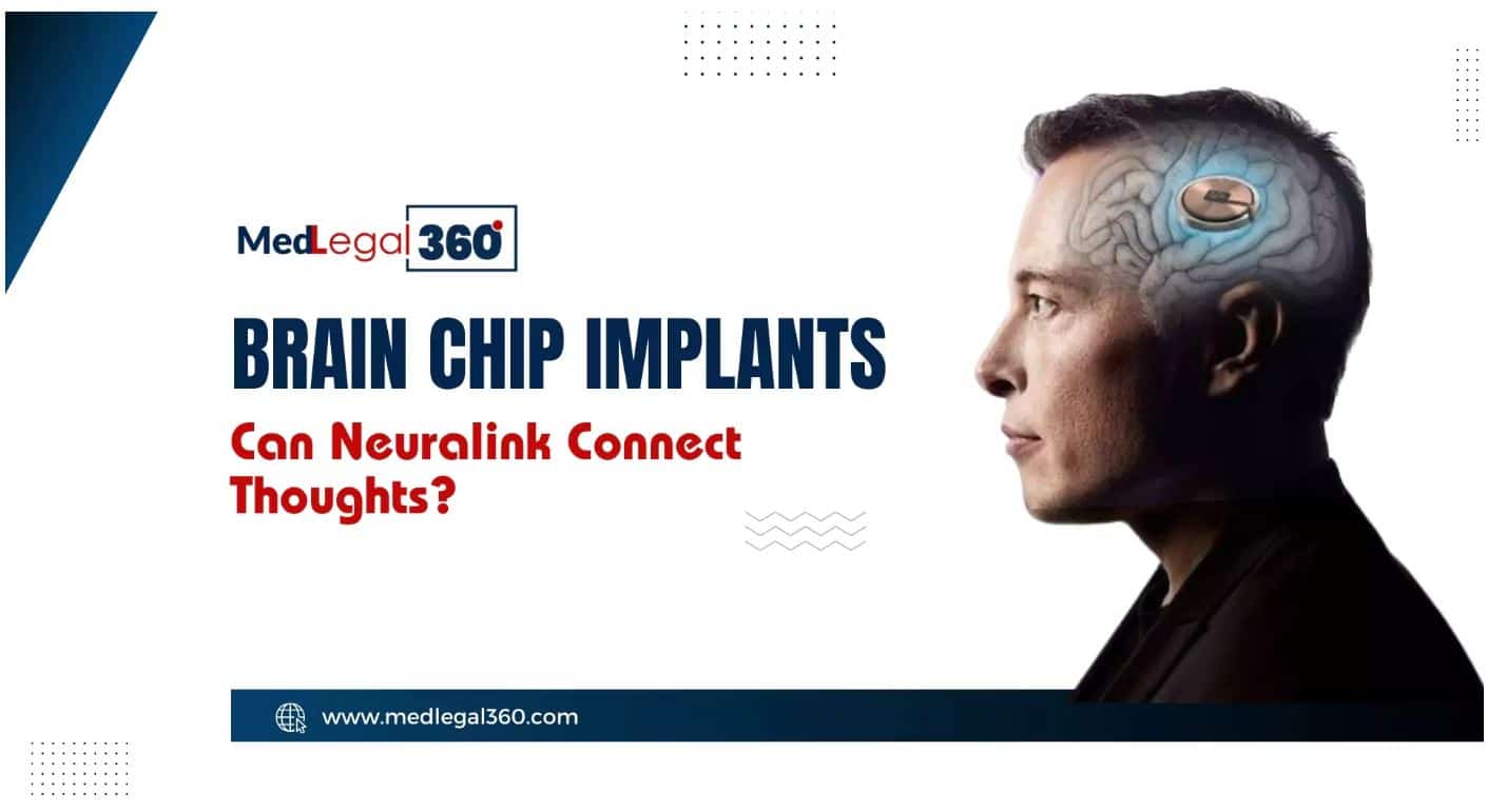 Brain Chip Implants