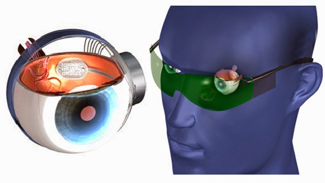 Retinal Implant Market Share, Comprehensive Analysis, Opportunity Assessment