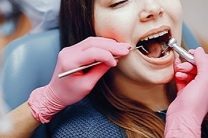 Exploring the Cost-Effectiveness of Dental Sealants in The Colony vs. Fillings