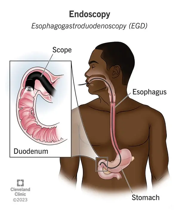 A Comprehensive Guide to Endoscopy Procedures with Redding Gastroenterology