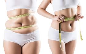 Achievement of Aesthetic Goals: Liposuction in Islamabad Pakistan