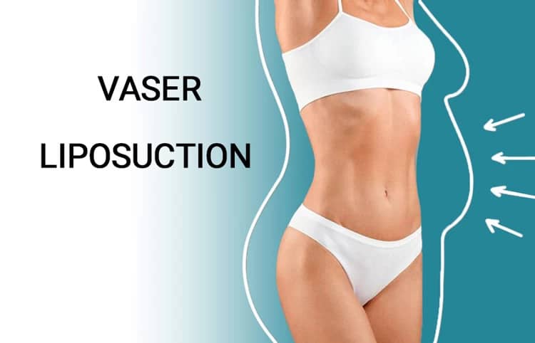 Vaser Liposuction and Patient Satisfaction in Dubai