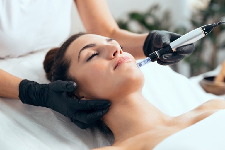 Dubai’s Best-Kept Beauty Secret: Microneedling Unveiled