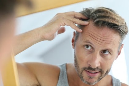 Which is preferable: hair transplant vs. scalp micropigmentation?