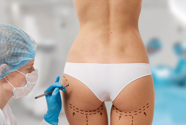 The Popularity of Brazilian Butt Lift Procedures in Dubai