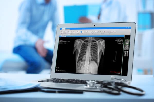 Top Things To Know About X-Ray Radiography And The Types Of Digital Imaging