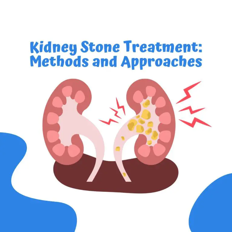 Comprehensive Guide to Kidney Stone Treatment: Methods and Approaches