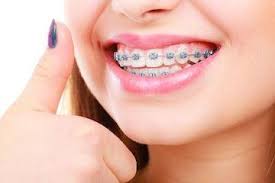 Importance of Pediatric Orthodontists in Shaping Smiles