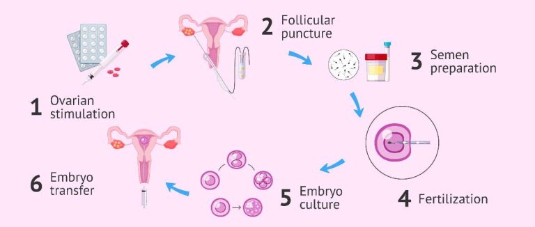 In Vitro Fertilization Market Trends and Growth Drivers: An Overview