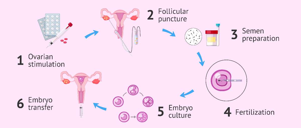 In Vitro Fertilization Market