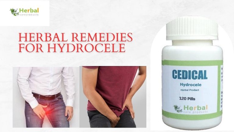 Best Natural Remedies for Hydrocele Treatment at Home