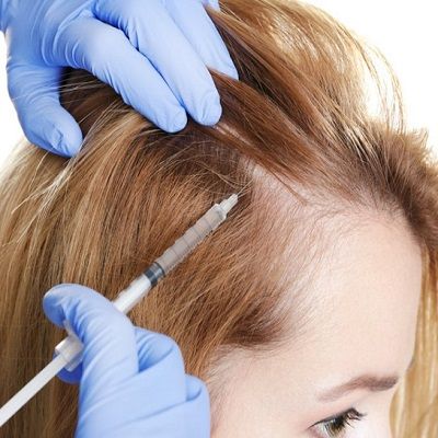 “PRP Hair Treatment Innovations: Latest Trends in Dubai”