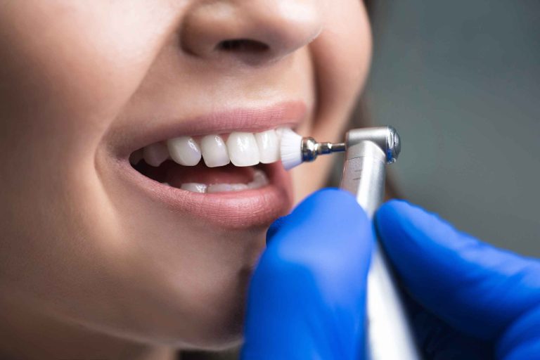 Teeth Cleaning 101: Essential Facts and Tips for Oral Health