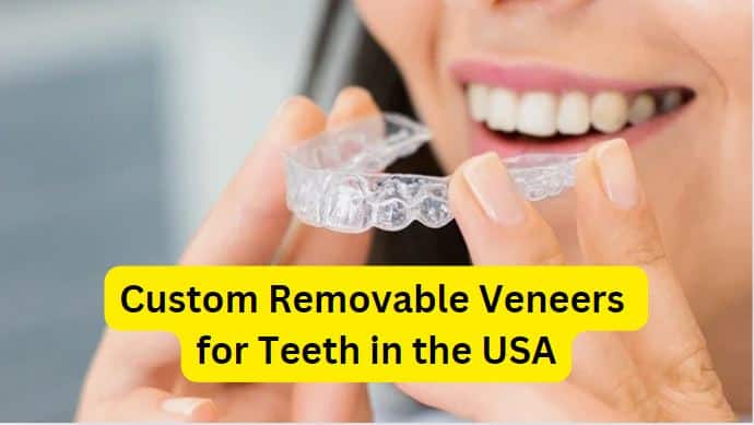 The Cost of Removable Veneers: What to Expect and How to Budget