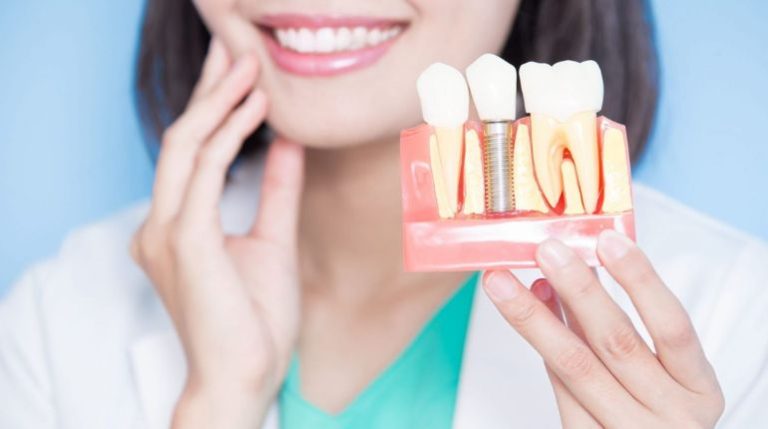 Unveiling the Cost of Dental Implants in India: Planning for a Brighter Smile